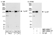 NBP1-05952 - VPRBP