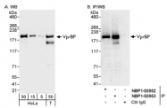NBP1-05953 - VPRBP