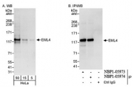 NBP1-05973 - EMAP4 / EML4