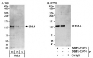 NBP1-05974 - EMAP4 / EML4
