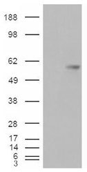 NBP1-06096 - VTCN1 / B7H4