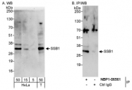 NBP1-06561 - OBFC2B