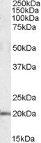 NBP1-06996 - U2AF1L4 / U2AF1L3