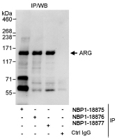 NBP1-18876 - ABL2