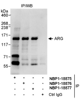 NBP1-18877 - ABL2