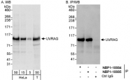 NBP1-18884 - UVRAG