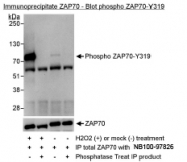 NBP1-18896 - ZAP70