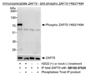 NBP1-18898 - ZAP70