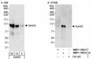 NBP1-18913 - EPHA2 / ECK