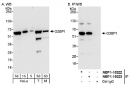 NBP1-18922 - G3BP1 / G3BP