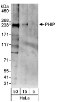NBP1-19095 - WDR11 / PHIP
