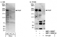 NBP1-19096 - WDR11 / PHIP