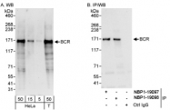 NBP1-19098 - BCR