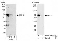 NBP1-19108 - UTP3 / SAS10