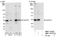 NBP1-19120 - U2AF1 / U2AF35