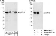 NBP1-19122 - TOR1AIP1