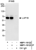 NBP1-19123 - TOR1AIP1
