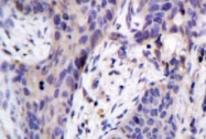 NBP1-19353 - Bcl-2-like 8