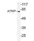 NBP1-19365 - ATRIP / AGS1