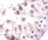 NBP1-19397 - HDAC6