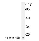 NBP1-19400 - Histone H2B