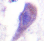 NBP1-19408 - HGS / HRS