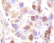 NBP1-19430 - RPA2