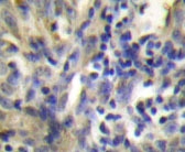 NBP1-19433 - Cystatin-A