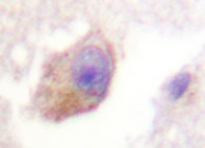 NBP1-19436 - Tryptophan 5-hydroxylase 1 (TPH1)