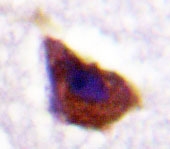NBP1-19449 - Beta-2 adrenergic receptor