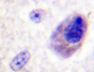 NBP1-19451 - Bcl-2-like 8