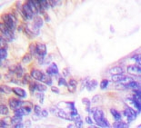 NBP1-19482 - RPS6KA1