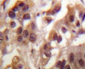 NBP1-19506 - NEMO / IKBKG