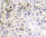 NBP1-19508 - XRCC6 / Ku70