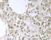 NBP1-19522 - NEMO / IKBKG