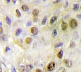 NBP1-19569 - ROR-alpha / RORA