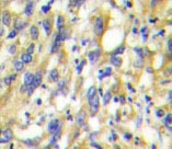 NBP1-19611 - DUSP9 / MKP4