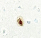 NBP1-19630 - BUB3