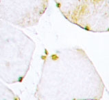 NBP1-19674 - Uracil-DNA glycosylase (UNG)