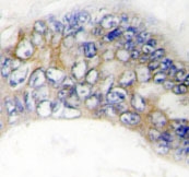 NBP1-19717 - TNFRSF6B / DCR3