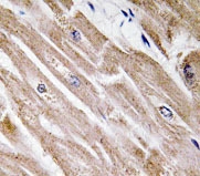 NBP1-19736 - BMP5