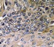 NBP1-19757 - Interleukin-8 / IL8