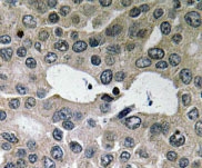 NBP1-19759 - BNIP2