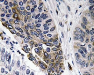 NBP1-19790 - Human IgA
