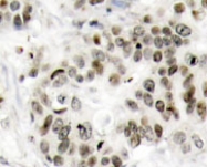 NBP1-19873 - MAPK8 / JNK1