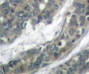 NBP1-19887 - DOK1 / p62 dok
