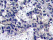 NBP1-19890 - EIF2AK2 / PKR