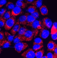 NBP1-20224 - TRPM7