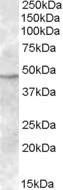 NBP1-20985 - TMPRSS4