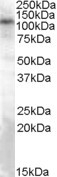 NBP1-20989 - TRPC4 / TRP4